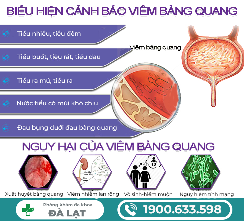 Hình ảnh minh họa